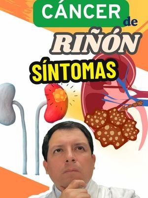 🩺 Cáncer de Riñón: Síntomas y Manejo 🍽️ El cáncer de riñón es un tipo de cáncer que comienza en los riñones, los órganos encargados de filtrar los desechos y el exceso de líquidos del cuerpo. Aunque este tipo de cáncer puede afectar a cualquier persona, es más común en personas mayores de 50 años y suele ser más frecuente en hombres. La detección temprana es clave para el tratamiento, ya que el cáncer de riñón en etapas avanzadas puede diseminarse a otras partes del cuerpo. Aquí te explicamos los síntomas más comunes y las opciones de manejo para el cáncer de riñón. 🔹 Síntomas Comunes 🚨 Sangre en la orina (hematuria) 💉 Uno de los primeros síntomas de cáncer de riñón es la presencia de sangre en la orina, lo que puede hacer que la orina tenga un color rojizo o marrón. Esto ocurre debido a que el tumor en el riñón puede sangrar. Dolor en la parte inferior de la espalda 💥 El dolor persistente en el área lumbar, especialmente en un solo lado del abdomen o la espalda, es otro síntoma común. Este dolor generalmente no mejora con el descanso. Pérdida de peso inexplicada ⚖️ La pérdida de peso sin razón aparente es común en muchos tipos de cáncer, incluido el cáncer de riñón. Esto puede ocurrir incluso sin cambios en la dieta o el ejercicio. Fatiga 😴 La fatiga extrema es un síntoma común del cáncer de riñón, ya que el cuerpo lucha contra la enfermedad. Hinchazón de los tobillos o piernas 🍽️ La hinchazón o retención de líquidos en las piernas, los tobillos o el abdomen puede ocurrir cuando los riñones ya no pueden filtrar los desechos adecuadamente. Fiebre persistente 🌡️ En algunos casos, el cáncer de riñón puede causar fiebre sin una infección aparente. 🔹 Manejo del Cáncer de Riñón 🏥 El tratamiento para el cáncer de riñón depende de su tamaño, ubicación y si se ha diseminado. Las opciones de manejo incluyen: Cirugía 🏥 La nefrectomía es la cirugía más común para el cáncer de riñón. Implica la extirpación parcial o total del riñón afectado. Si el cáncer se detecta en una etapa temprana y no se ha diseminado, esta cirugía puede curar la enfermedad. Terapia dirigida 💉 Los tratamientos de terapia dirigida atacan específicamente las células cancerosas sin dañar tanto las células sanas, lo que puede ser útil en el tratamiento del cáncer de riñón avanzado. Inmunoterapia 🧬 La inmunoterapia estimula el sistema inmunológico para que ataque las células cancerosas. Este tratamiento ha demostrado ser eficaz en algunos pacientes con cáncer de riñón avanzado. Quimioterapia y radioterapia ⚡ Aunque no son tan comunes en el tratamiento del cáncer de riñón, en algunos casos, se pueden usar para reducir el tamaño de los tumores o aliviar los síntomas. 🥗 Consejo: Si experimentas síntomas como sangre en la orina o dolor persistente en la espalda, es importante buscar atención médica para un diagnóstico temprano. Detectar el cáncer de riñón a tiempo mejora las posibilidades de un tratamiento exitoso. #CáncerDeRiñón #SaludRenal #Bienestar #CuidadoDeLaSalud #Prevención #dr_luispacora #luispacoracamargo #LIVEIncentiveProgram #LIVEStory #PaidPartnership 
