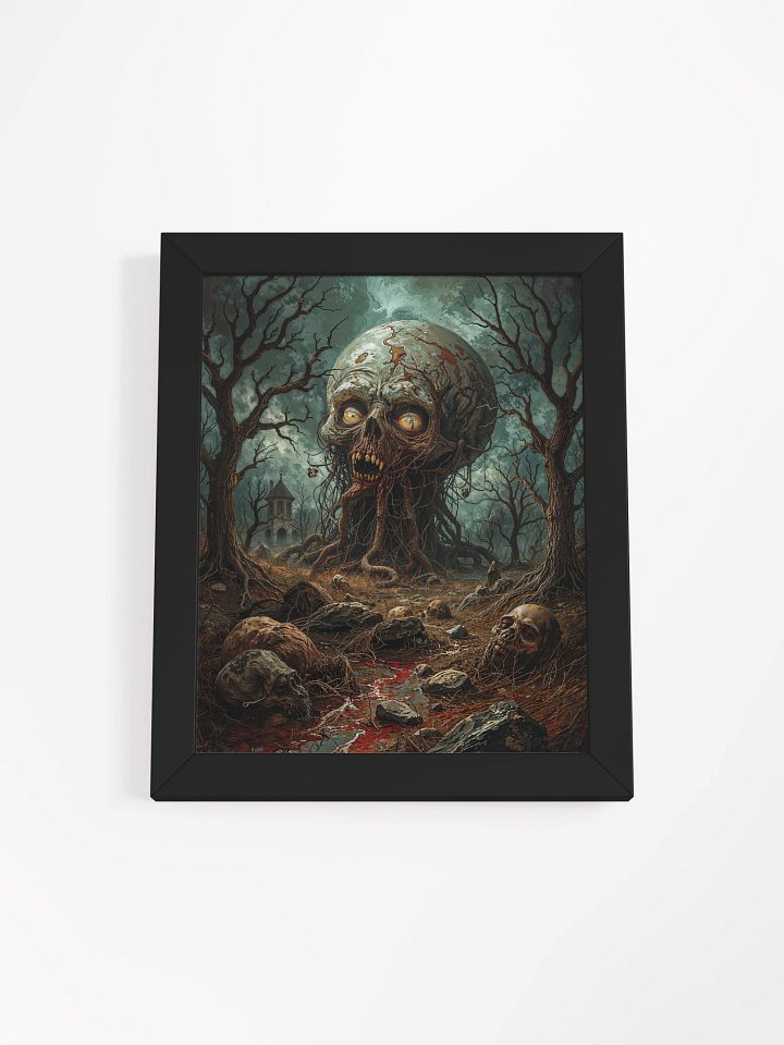 The Skull That Ate the Forest Framed Print product image (4)