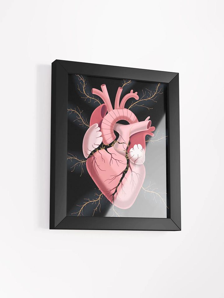 Cracked Heart Gold Veins Art | Emotional Support Symbolism Print product image (2)