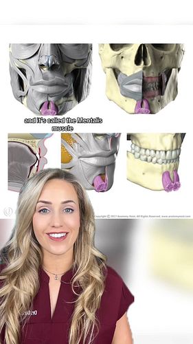 Have you heard of this before?

#bonebeard #doctor #medical #interesting