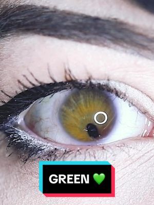 Only my right eye though 🥺 #greeneyes #hazeleyes #heterochromia #birthdefect #eyes #girlwiththedragoneyes 