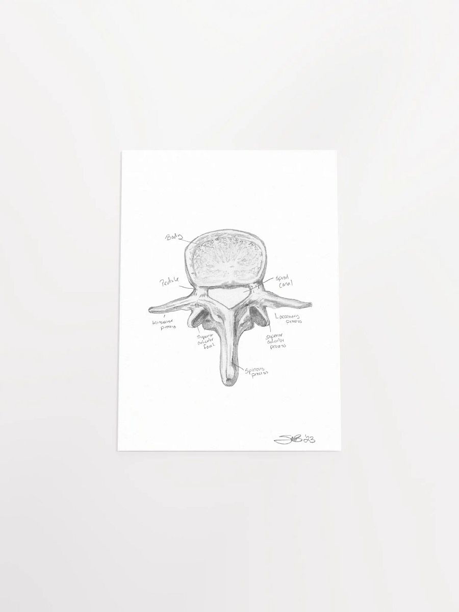 Lumbar Vertebrae Wall Art (Labeled) product image (7)