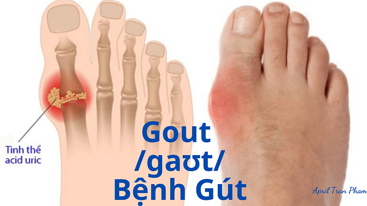 Vocabulary about diseases product image (2)