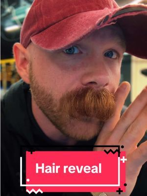 You’re worth more than your insecurities ❤️‍🩹 #hair #reveal #burn #burns #firefighter #charity #love #change #bold #insecurity #give #hope #daughter #bald #itsokay #me #community 