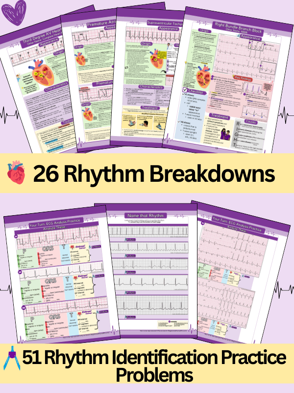 ECG/EKG Interpretation Study Guide & Workbook by Nurse Sarah (Digital) product image (2)