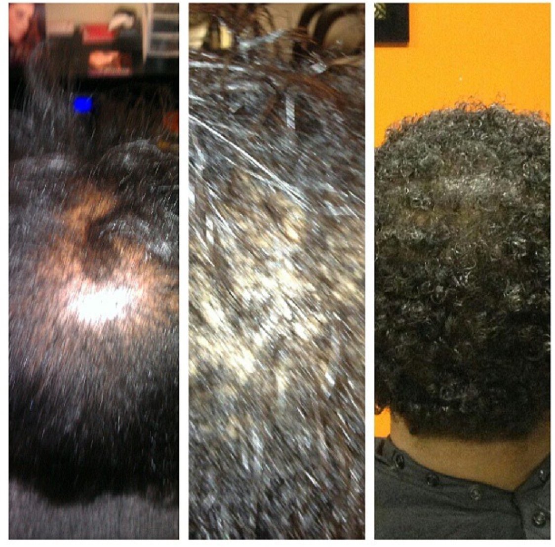 Miracle Growth Water Dry Rice Water Hair Treatment product image (3)