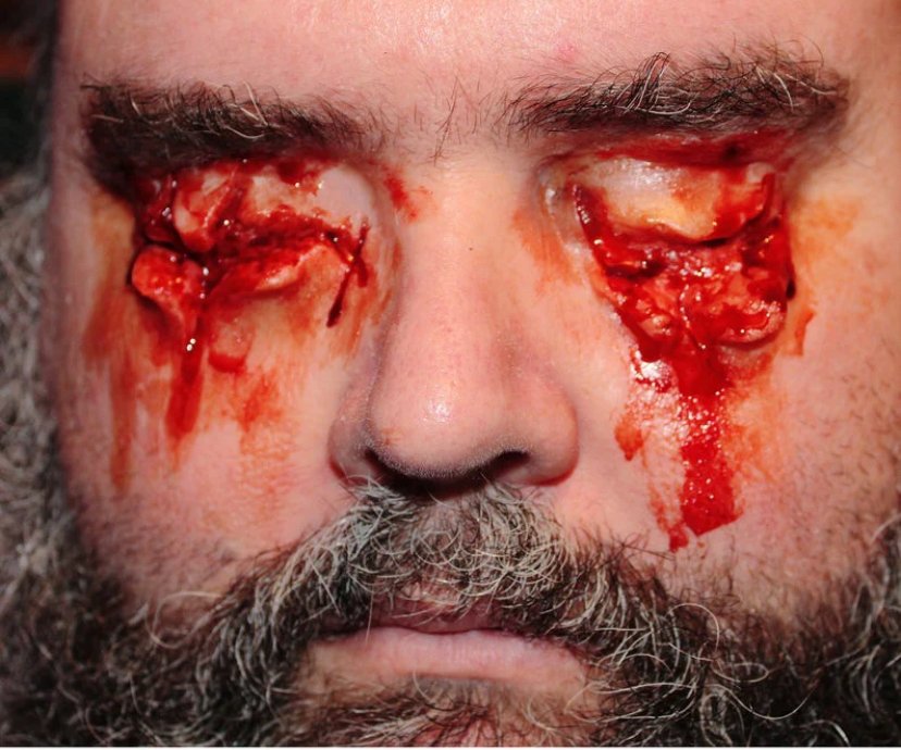 Jess FX - Appliance - Silicone Gouged Out Eyes Prosthetic product image (1)