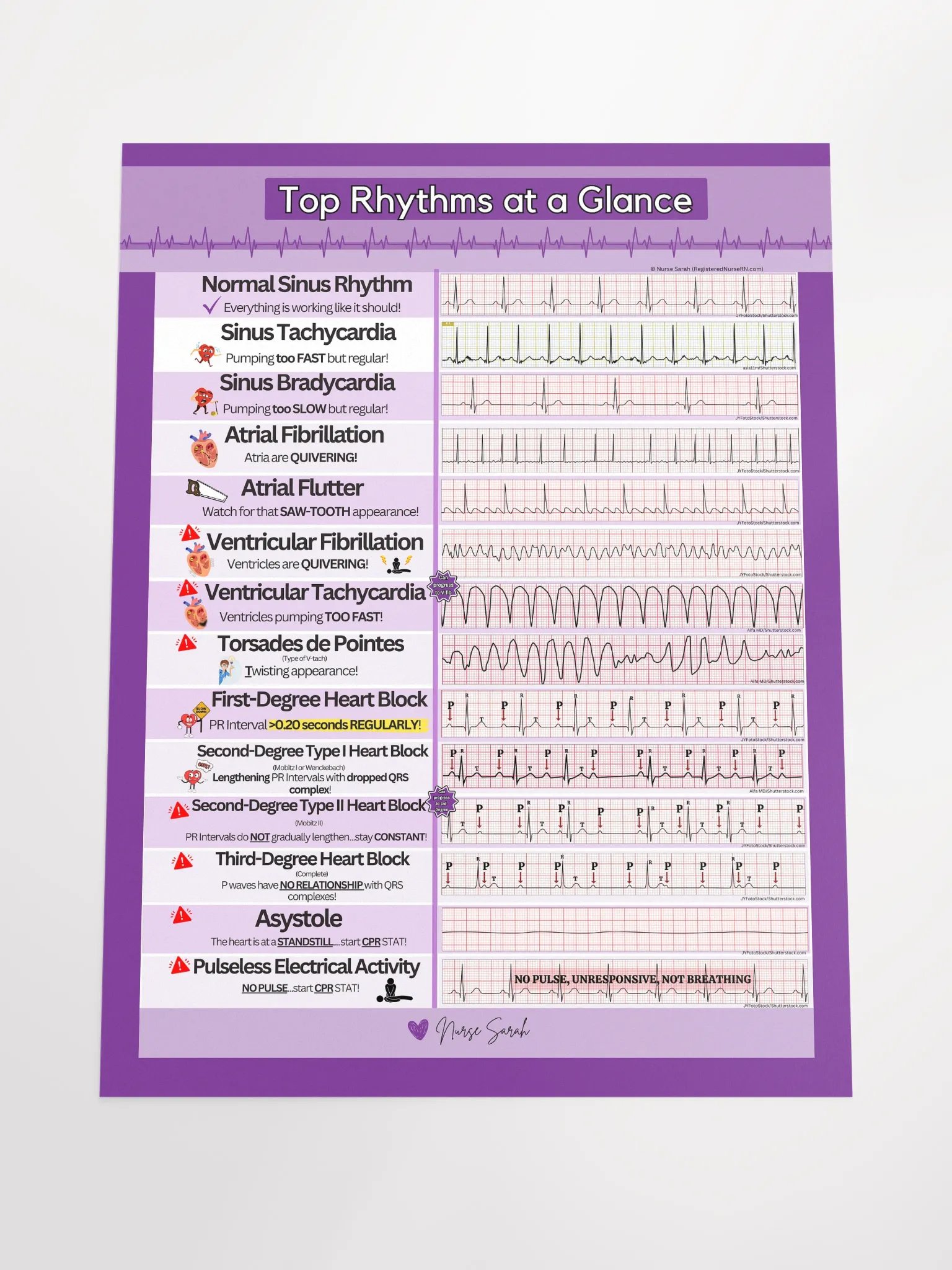 ECG/EKG Rhythms at a Glance Wall Poster by Nurse Sarah product image (4)